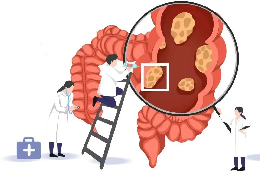 莆田福德医院-消化内科-多数患者确诊时已为中晚期