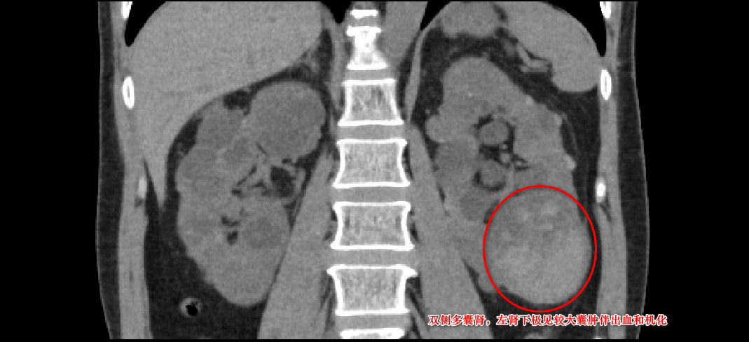 莆田福德医院泌尿肾病科收获锦旗